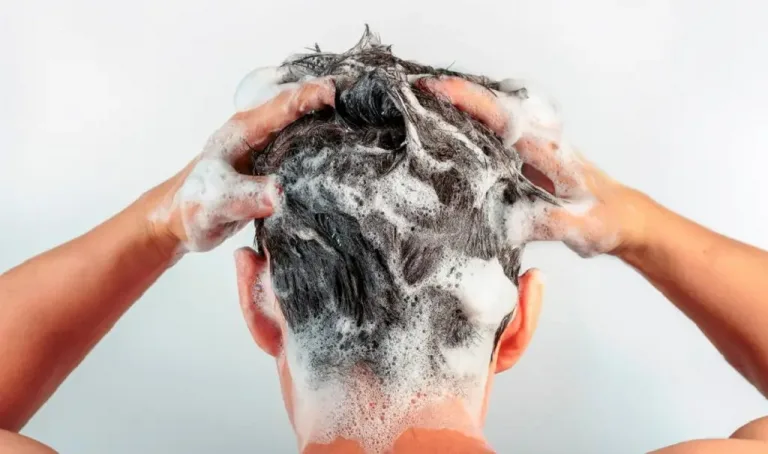 7-Best-Dandruff-Shampoo-for-Men.jpg