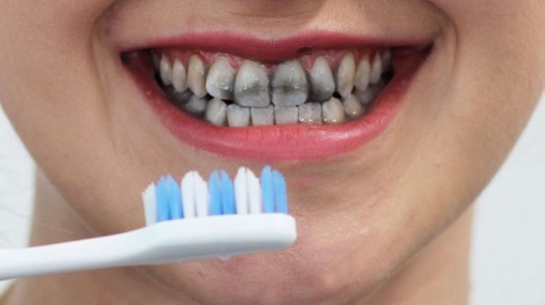 Best Charcoal Teeth Whitening Products